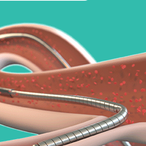 redwire medical guidewire 