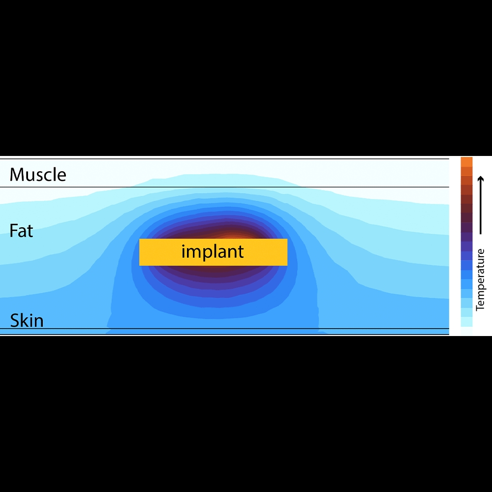visualized heating effect of a wirelessly charged medical implant