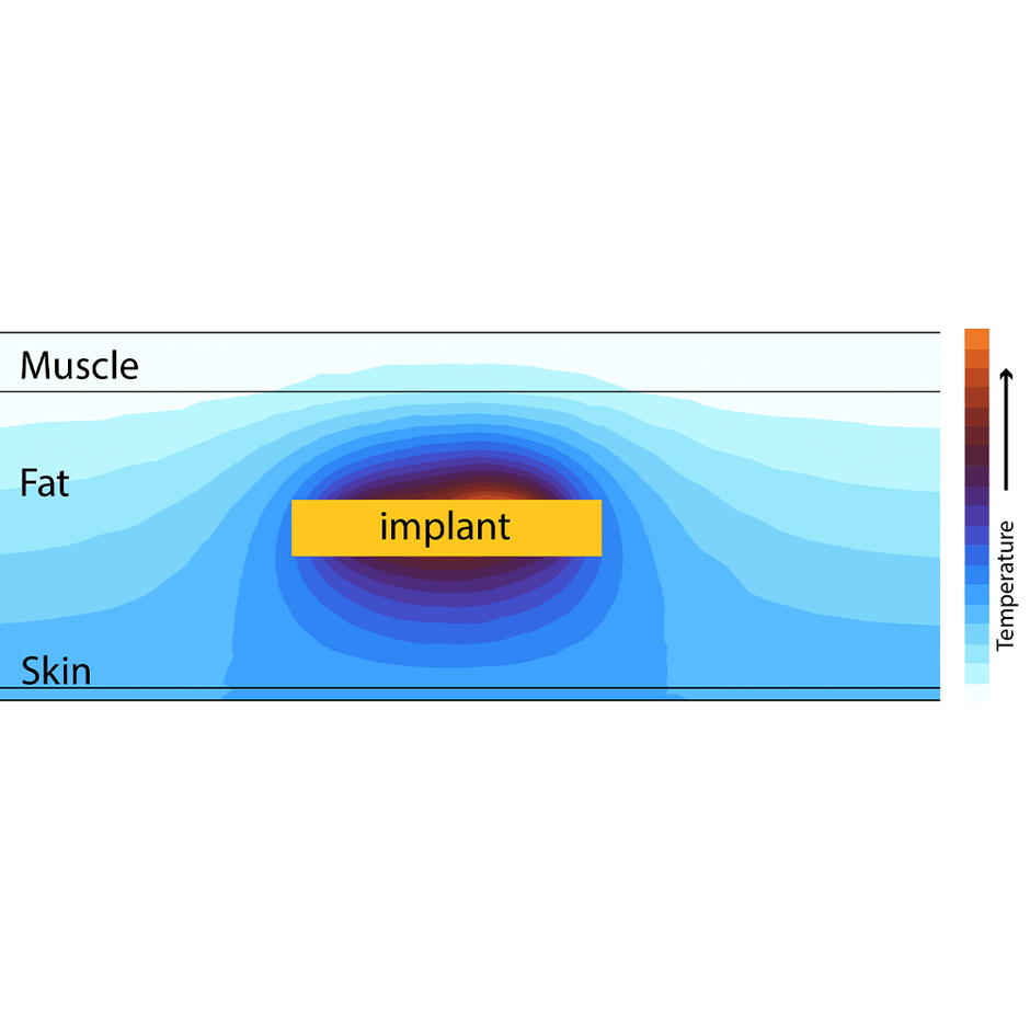 wireless charging of a medical implant.