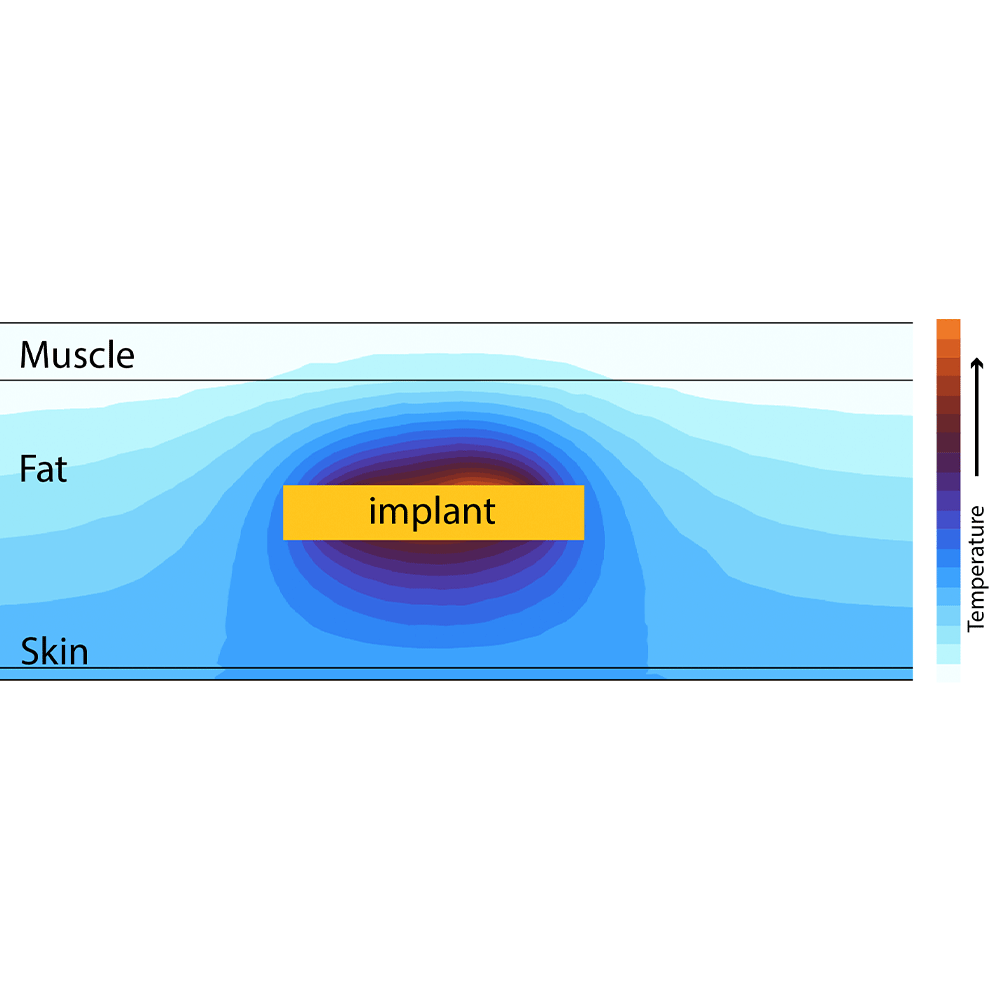 visualisierter Heizeffekt eines drahtlos geladenen medizinischen Implantats